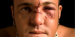 إتحاد WWE أكثر خطورة من NJPW علي حياة المصارعين